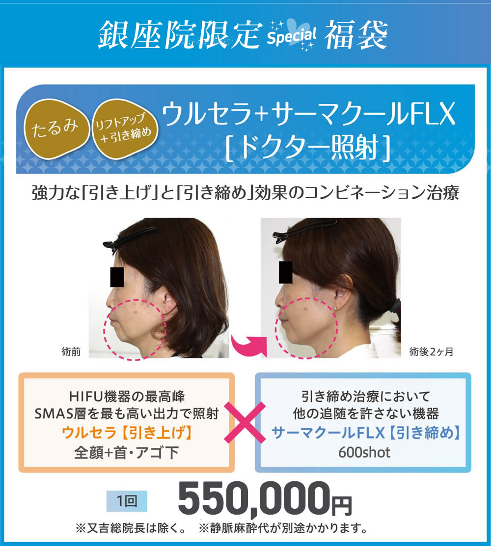 銀座院限定Special福袋　ウルセラ＋サーマクールFLX[ドクター照射]