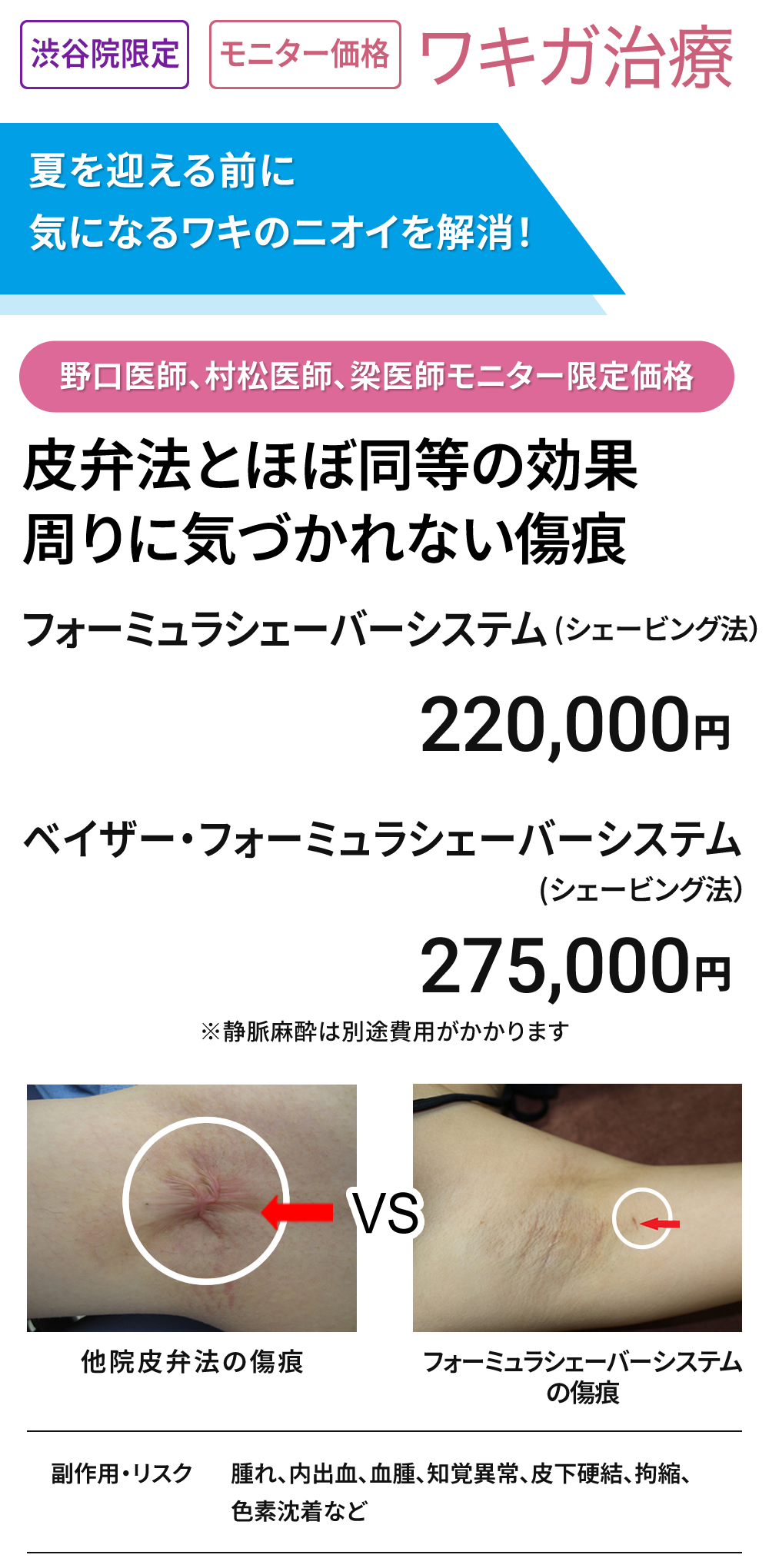 渋谷院限定　ワキガ治療　モニター