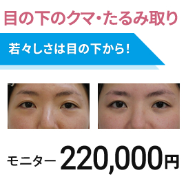 目の下のクマ・たるみ取り　経結膜脱脂術　モニター