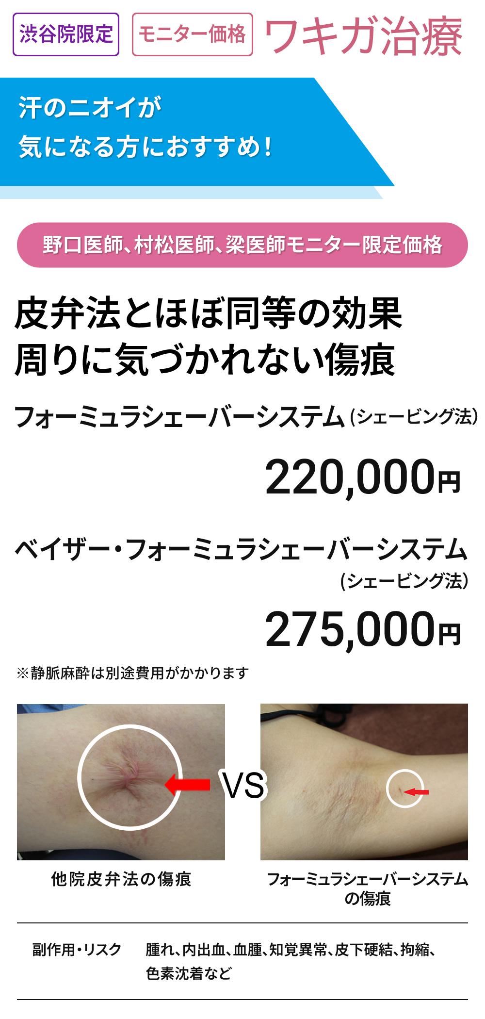 渋谷院限定 モニター募集　汗のニオイ　ワキガ治療